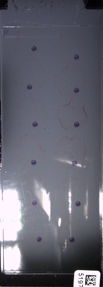 Media type: image; Special Collections 4011   shows specimen_part histological serial section;